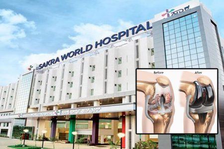 Sakra Hospital in Karnataka conducts 1000 knee replacements through navigational surgery