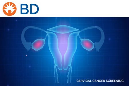 BD introduces new Liquid Based Cytology technique to enable accurate cervical cancer screening