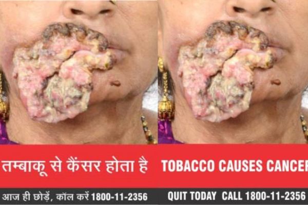 eh-tobacconewwarnings1