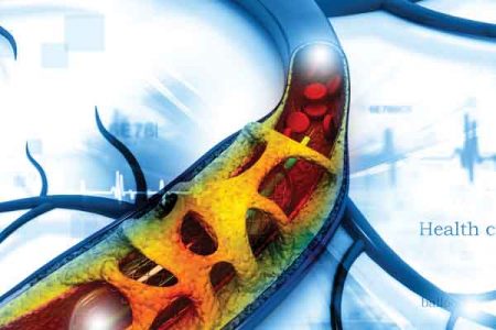 Indian stent makers: No more on the  fringes of business