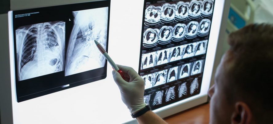 Cad4covid Xray Can Identify Characteristics Of Covid 19 On Chest Radiographs With Performance Comparable To Six