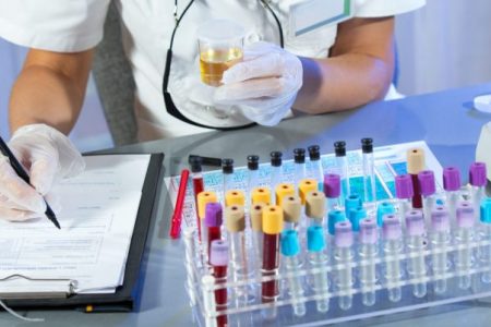 Five-minute urine test developed to reveal quality of diet