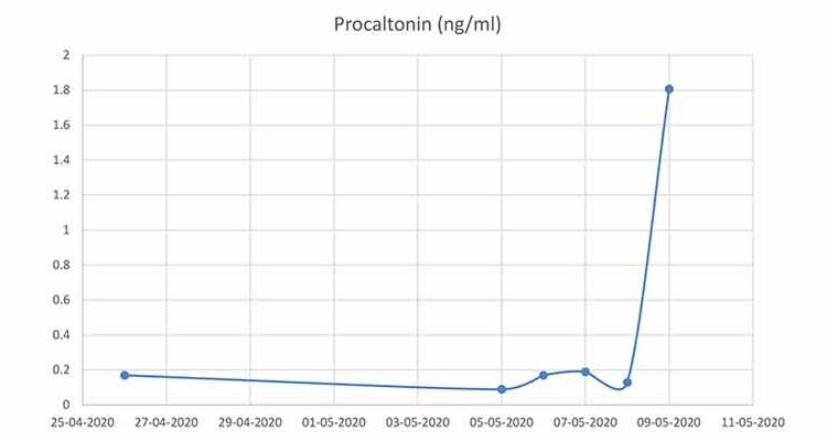EH_Graph_Procaltonin (ngml)_04