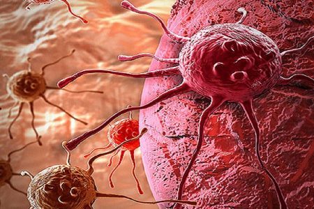 Cells damaged by chronic lung disease can result in severe COVID