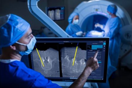 SPARSH Hospital introduces surgical imaging and navigation system