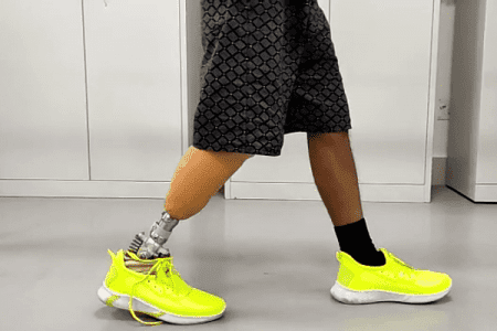 IIT Guwahati develops prosthetic leg with advanced features