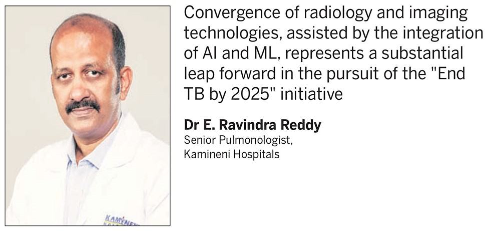 Madhu Reddy Radiologist Radiology & imaging revolution in India's TB battle - Express Healthcare