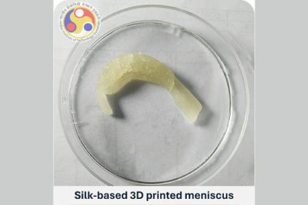 IIT-G develop treatment solutions for Knee Meniscus Tears