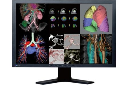 FUJIFILM India introduces Lung Navigation – Synapse 3D
