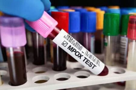 Redcliffe Labs launches mpox testing